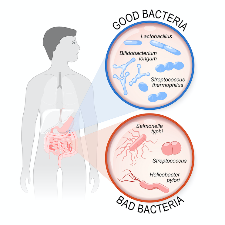 Gut feelings: what happens when your microflora is out of balance